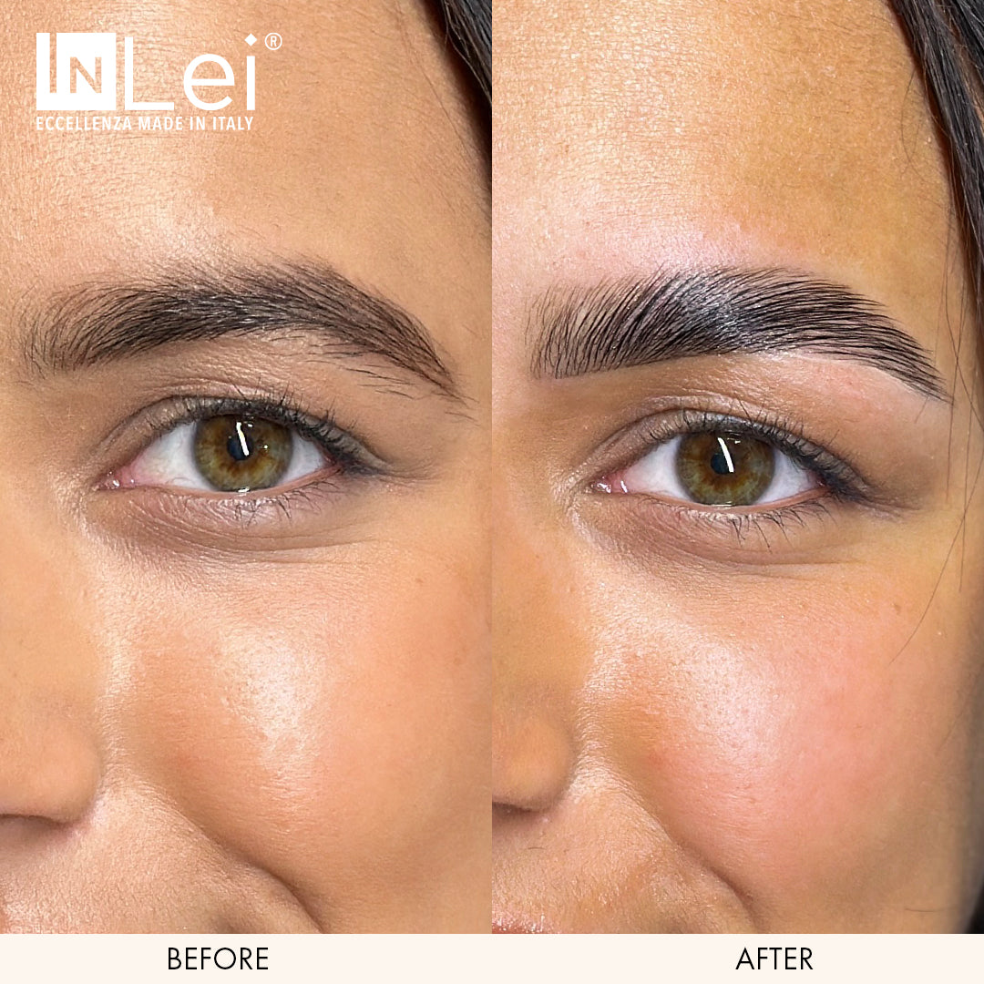 Comparación de antes y después del ojo de una mujer con la marca InLei.