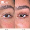 Modelo antes y después de InLei® Filler 3